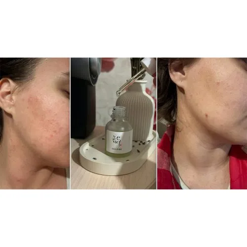 سرم ضد التهاب و آبرسان چای سبز و پنتنول بیوتی آف جوسان Beauty of Joseon Calming Barrier Serum