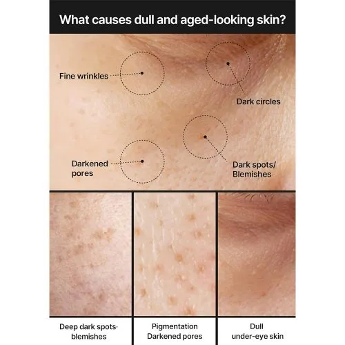 کرم ضد لک سلیمکس Celimax Pore Dark Spot Brightening Cream | روشن کننده
