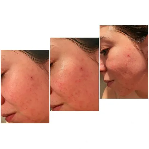 سرم ضد لک و روشن کننده تیام TIAM Vita B3 Source Serum