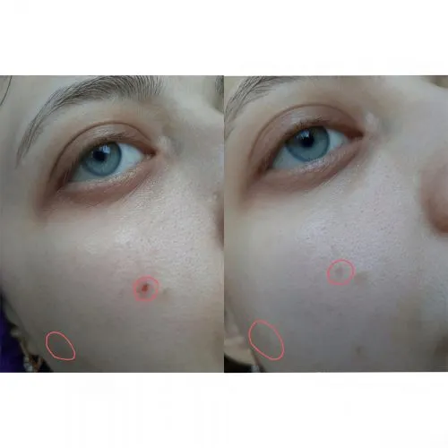 کرم نقطه ای ضد لک و جوش تیام TIAM AC Fighting Spot RX Cream