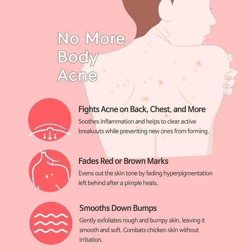 وسیون بدن ضد لک و روشن کننده تیام TIAM Anti-Blemish Body Lotion