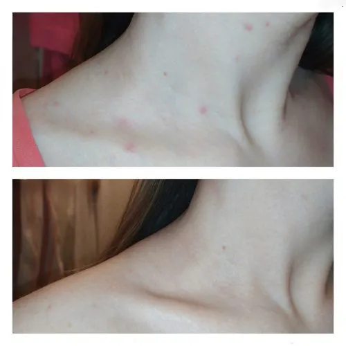 وسیون بدن ضد لک و روشن کننده تیام TIAM Anti-Blemish Body Lotion