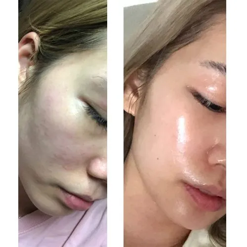 ماسک خواب حلزون و آزولن تیام TIAM Snail & Azulene Sleeping Mask  | ترمیم کننده و آبرسان