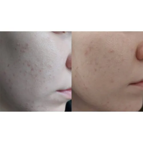 میست تونر نیاسینامید تیام TIAM Vita B3 Mist Toner | روشن کننده و آبرسان